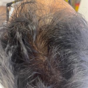 Hair Treatment - Before